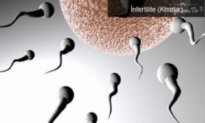 İnfertilite (Kısırlık)