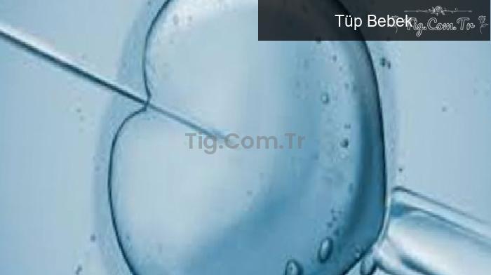 Tüp Bebek