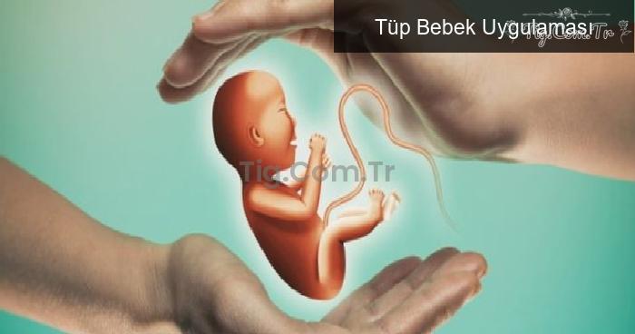 Tüp Bebek Uygulaması